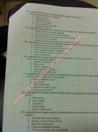 Protetik Diş Tedavisi 1.Vize Soruları 2011