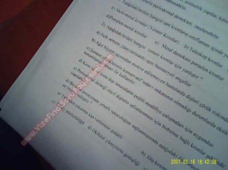 Protetik Diş Tedavisi Final Soruları