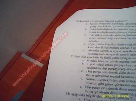Protetik Diş Tedavisi Final Soruları