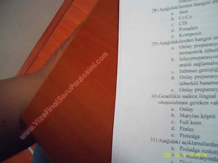 Protetik Diş Tedavisi Final Soruları