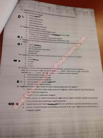 Protetik Diş Tedavisi Final Soruları - 2014