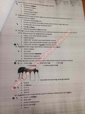 Protetik Diş Tedavisi Final Soruları - 2014