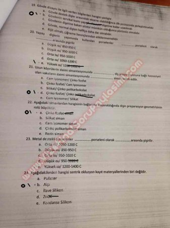 Protetik Diş Tedavisi Final Soruları - 2014