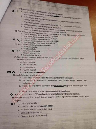 Protetik Diş Tedavisi Final Soruları - 2014