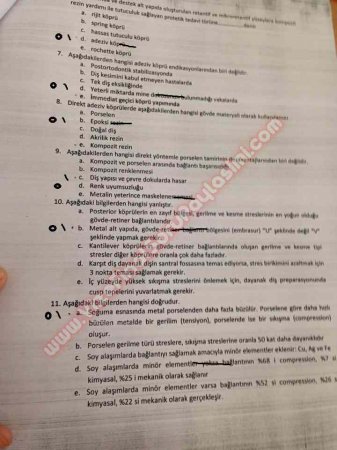 Protetik Diş Tedavisi Final Soruları - 2014