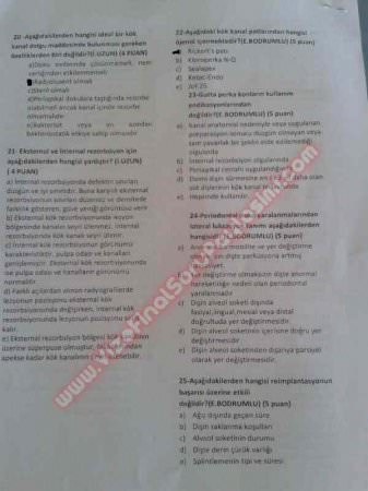 Endodonti Final soruları 2014