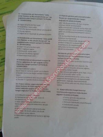 Endodonti Final soruları 2014