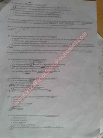 Ortodonti 2.Vize Soruları