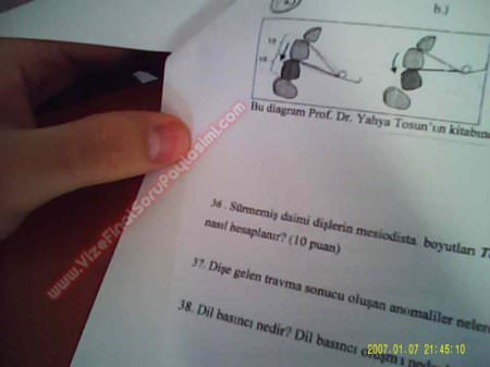 Ortodonti Final Soruları