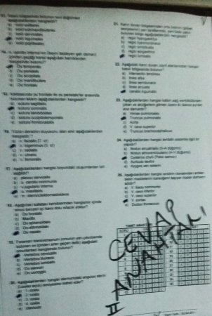 Anatomi 1.Vize Soruları ve Cevapları - 2015 (Hemşirelik)