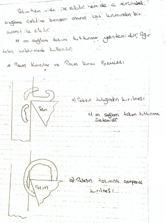 Plaket Uçların Takımı ve Bağlama Modelleri