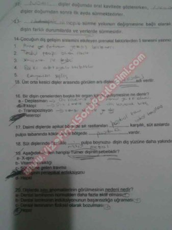 Pedodonti 1.Vize Soruları