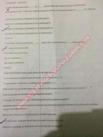 Pedodonti 2.Vize Soruları Ve Cevapları