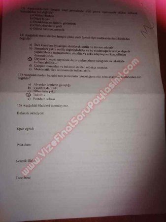 Protetik Diş Tedavisi 1.Vize Soruları 2013