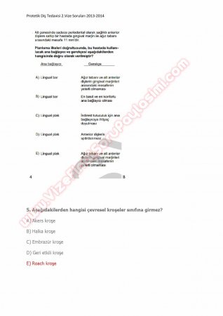 Protetik Diş Tedavisi 2.Vize Soruları 2014