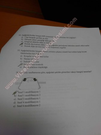 Protetik Diş Tedavisi 2.Vize Soruları 2015