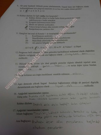 Protetik Diş Tedavisi 2.Vize Soruları 2015