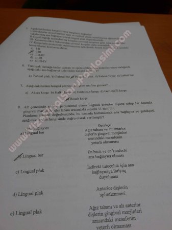 Protetik Diş Tedavisi 2.Vize Soruları 2015