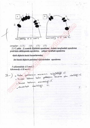 Protetik Diş Tedavisi Çıkmış Sorular