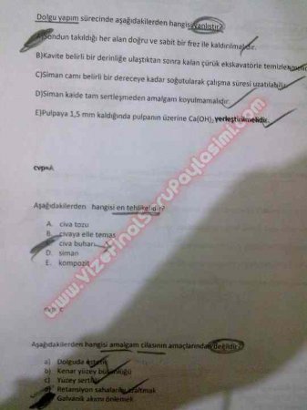 Endodontiye Giriş Çıkmış Sorular