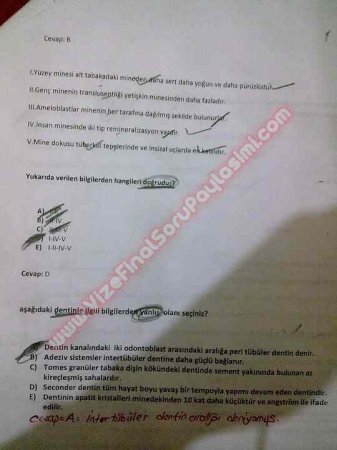 Endodontiye Giriş Çıkmış Sorular