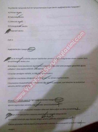 Endodontiye Giriş Çıkmış Sorular