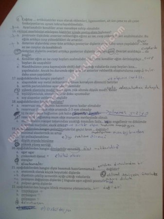 Protetik Diş Tedavisi Çalışma Soruları 2