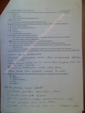 Protetik Diş Tedavisi Çalışma Soruları 2